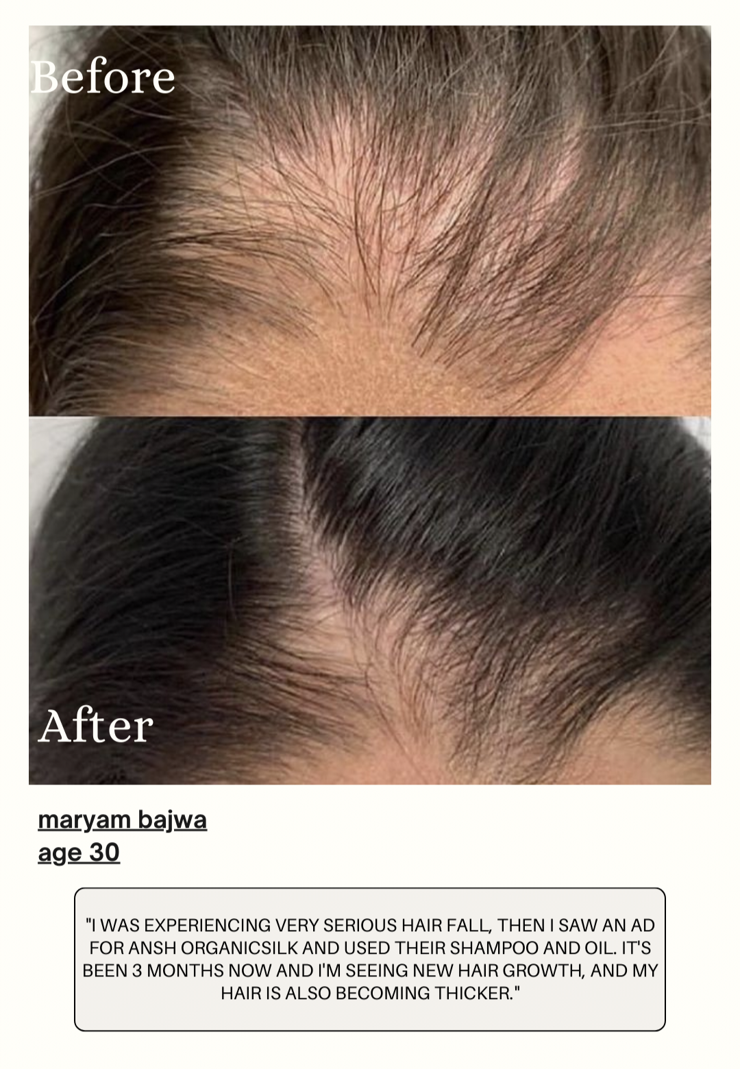 Regrow plus organic hair oil